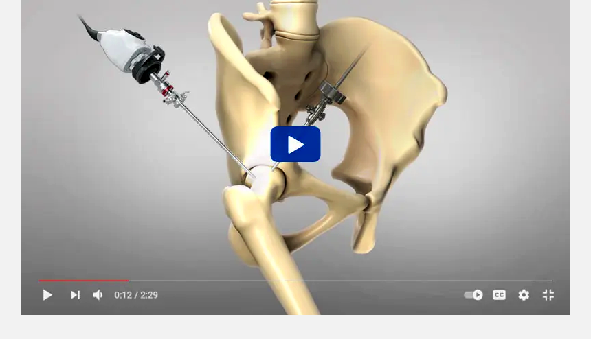Patient Education Videos